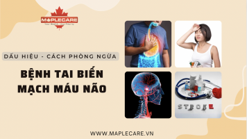 Dấu hiệu và cách phòng ngừa bệnh tai biến - Maple Care