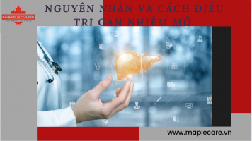 Nguyên nhân và cách điều trị gan nhiễm mỡ - Maple Care
